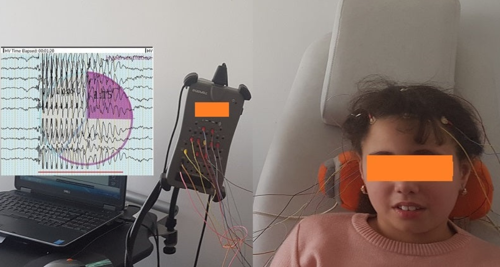 Module Epilepsie de l’enfant